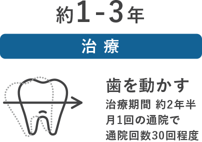 約1-3年［治療］歯を動かす（治療期間 約2年半 月1回の通院で回数30回程度）